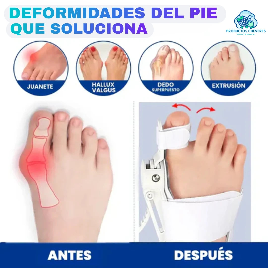 FlexiPie™ - Corrector de Juanete Ortopédico - Mi tienda